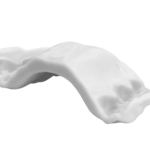 新発売の【インビザライン口蓋拡大システム】効果と価格を徹底解説!