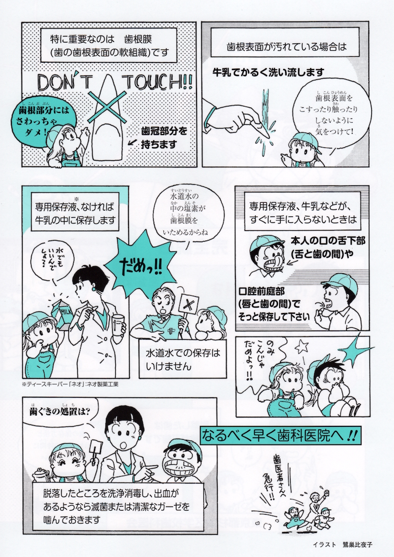 外傷歯