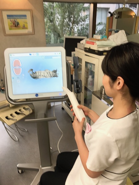 インビザライン用口腔内スキャン装置（iTero element）稼働しました