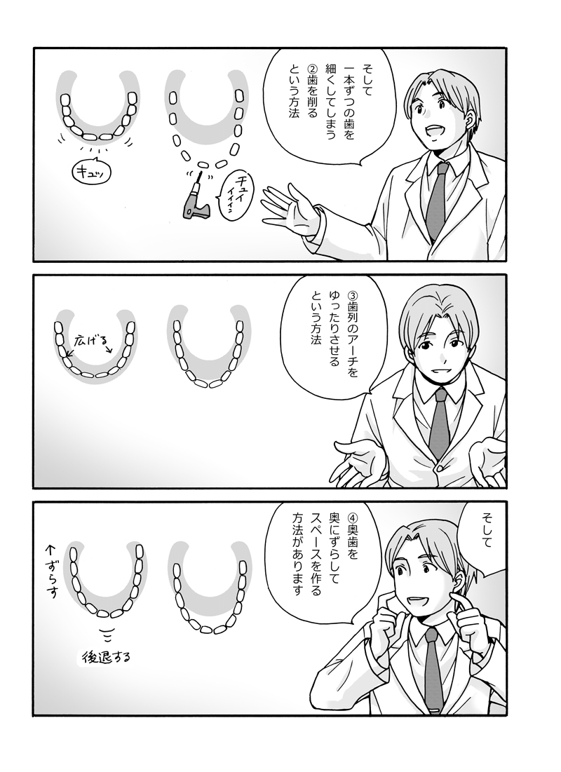 マンガでわかるインビザライン