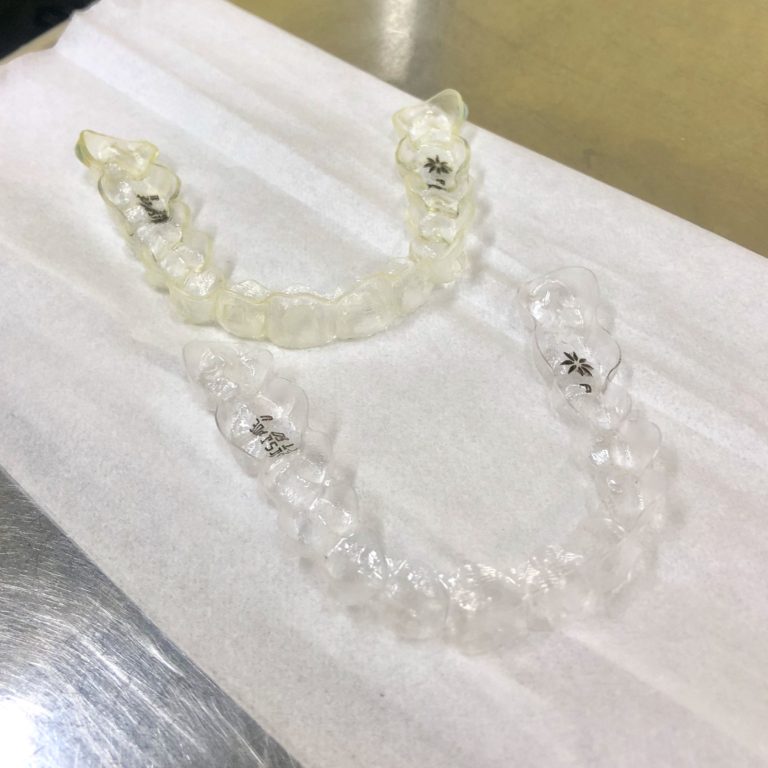 インビザライン生活