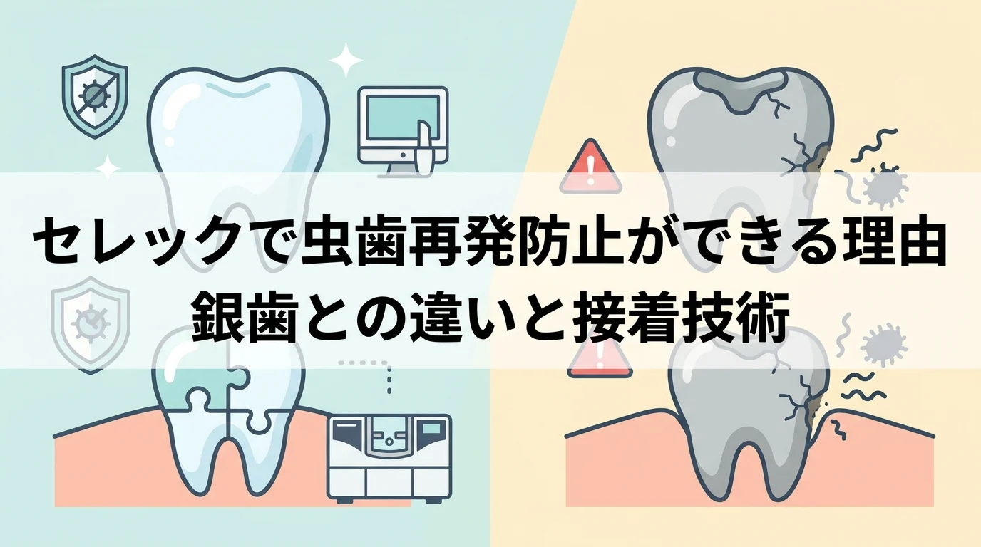 セレックで虫歯再発防止ができる理由｜銀歯との違いと接着技術
